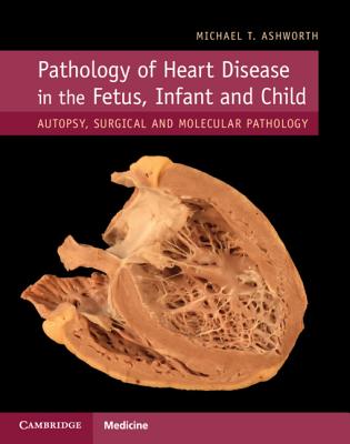 Pathology of Heart Disease in the Fetus, Infant and Child: Autopsy, Surgical and Molecular Pathology - Ashworth, Michael T