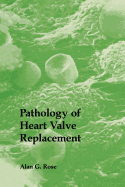 Pathology of Heart Valve Replacement
