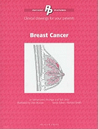 Patient Pictures: Breast Cancer: Clinical drawings for your patients. Illustrated by Dee McLean