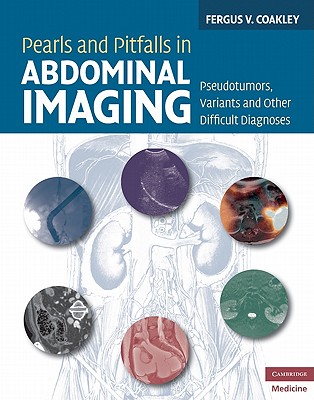 Pearls and Pitfalls in Abdominal Imaging: Pseudotumors, Variants and Other Difficult Diagnoses - Coakley, Fergus V