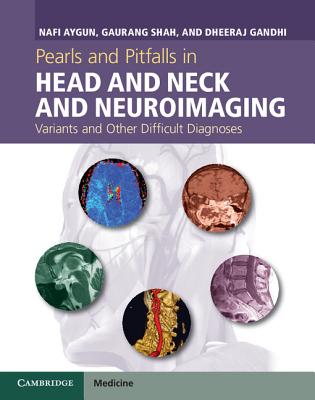 Pearls and Pitfalls in Head and Neck and Neuroimaging: Variants and Other Difficult Diagnoses - Aygun, Nafi, and Shah, Gaurang, and Gandhi, Dheeraj