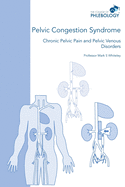 Pelvic Congestion Syndrome - Chronic Pelvic Pain and Pelvic Venous Disorders