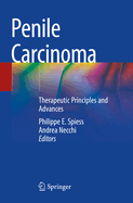 Penile Carcinoma: Therapeutic Principles and Advances