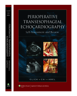 Perioperative Transesophageal Echocardiography: Self-Assessment and Review - Click, Roger L, MD, PhD, Facc, and Cai, Joy X, MD, and Abel, Martin D