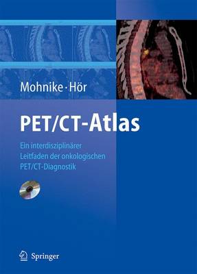 Pet/CT-Atlas: Ein Interdisziplin Rer Leitfaden Der Onkologischen Pet/CT-Diagnostik - Mohnike, K, and Hvr, G, and Mohnike, Wolfgang (Editor)