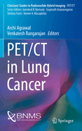Pet/CT in Lung Cancer