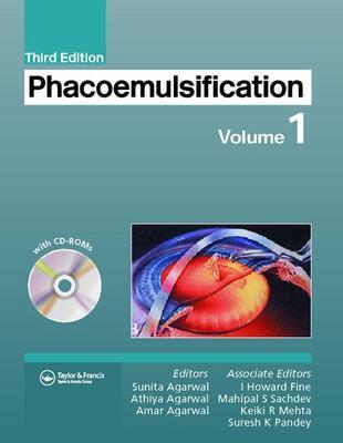 Phacoemulsification - Agarwal, Amar, Dr., MS, Frcs (Editor), and Agarwal, Athia (Editor), and Agarwal, Sunita, Dr. (Editor)