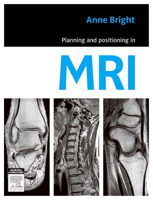 Planning and Positioning in MRI - Bright, Anne