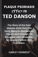 Plaque Psoriasis Effect on Ted Danson: The Story of the Sam Malone Actor from His Early Years to Stardom on Cheers and through His Struggles with Moderate-to-Severe Chronic Skin Condition