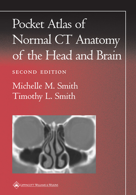 Pocket Atlas of Normal CT Anatomy of the Head and Brain - Smith, Michelle M, MD, and Smith, Timothy L, MD, MPH