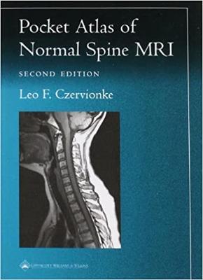 Pocket Atlas of Spinal MRI - Czervionke, Leo F, MD