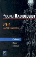 Pocketradiologist - Brain: Top 100 Diagnoses - Osborn, Anne G, MD, Facr