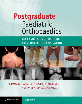 Postgraduate Paediatric Orthopaedics: The Candidate's Guide to the Frcs (Tr and Orth) Examination - Alshryda, Sattar (Editor), and Jones, Stan (Editor), and Banaszkiewicz, Paul A (Editor)