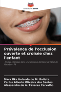 Pr?valence de l'occlusion ouverte et crois?e chez l'enfant