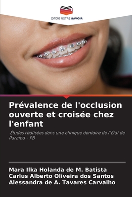 Pr?valence de l'occlusion ouverte et crois?e chez l'enfant - Holanda de M Batista, Mara Ilka, and Oliveira Dos Santos, Carlus Alberto, and Tavares Carvalho, Alessandra de a