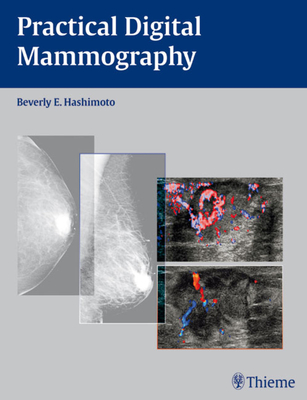 Practical Digital Mammography - Hashimoto, Beverly