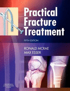 Practical Fracture Treatment - McRae, Ronald, and Esser, Max