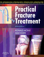 Practical Fracture Treatment