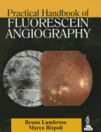 Practical Handbook of Fluorescein Angiography: Posterior Pole and Retinal Periphery