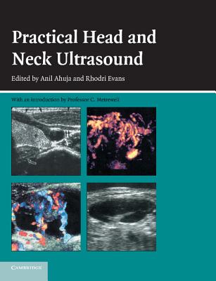 Practical Head & Neck Ultrasound - Ahuja, Anil T, MD (Editor), and Evans, Rhodri M (Editor)