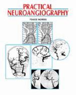 Practical Neuroangiography - Morris, Pearse