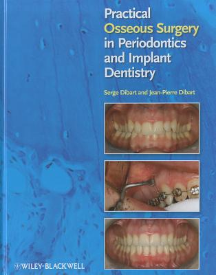 Practical Osseous Surgery in Periodontics and Implant Dentistry - Dibart, Serge, and Dibart, Jean-Pierre