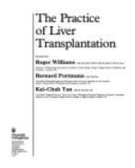 Practice of Liver Transplantation