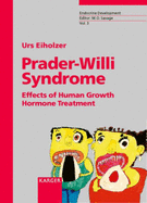 Prader-Willi Syndrome: Effects of Human Growth Hormone Treatment