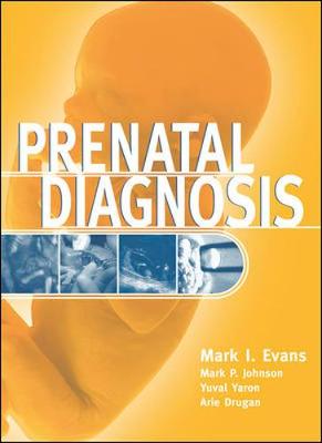Prenatal Diagnosis - Evans, Mark I, and Evans Mark
