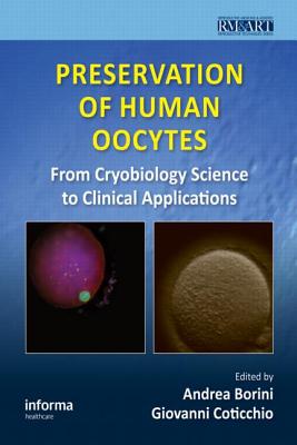 Preservation of Human Oocytes: From Cryobiology Science to Clinical Applications - Borini, Andrea (Editor), and Coticchio, Giovanni (Editor)