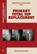 Primary Total Hip Replacement