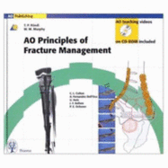 Principles of Fracture Management