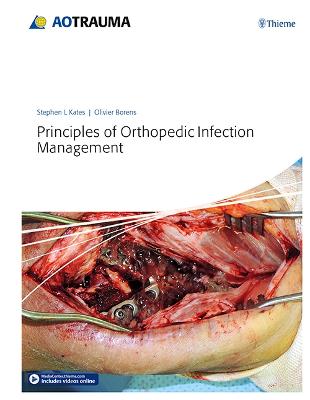 Principles of Orthopedic Infection Management - Kates, Stephen, and Borens, Olivier