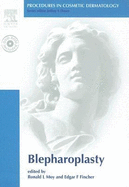 Procedures in Cosmetic Dermatology Series: Blepharoplasty: Text with DVD - Fincher, Edgard F, MD (Editor), and Moy, Ronald L, MD (Editor)