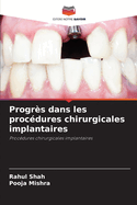 Progr?s dans les proc?dures chirurgicales implantaires