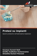 Protesi su impianti