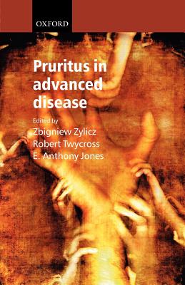 Pruritus in Advanced Disease - Zylicz, Zbigniew