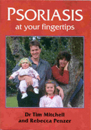 Psoriasis at Your Fingertips: The Essential Reference Guide to Dealing with Psoriasis - Mitchell, Tim, and Penzer, Rebecca, and Clarke, Gillian (Volume editor)