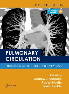 Pulmonary Circulation: Diseases and Their Treatment, Fourth Edition - Peacock, Andrew J. (Editor), and Naeije, Robert (Editor), and Rubin, Lewis J. (Editor)