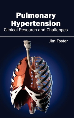 Pulmonary Hypertension - Clinical Research and Challenges - Foster, Jim (Editor)