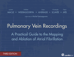 Pulmonary Vein Recordings: A Practical Guide to the Mapping and Ablation of Atrial Fibrillation