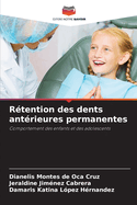 R?tention des dents ant?rieures permanentes