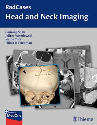 Radcases Head and Neck Imaging - Shah, Gaurang (Editor), and Wesolowski, Jeffrey Robert (Editor), and Choi, Jeanie (Editor)