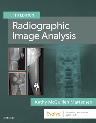 Radiographic Image Analysis - Martensen, Kathy McQuillen, Ma, Rt(r)