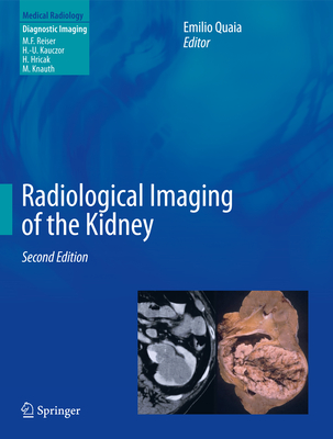 Radiological Imaging of the Kidney - Quaia, Emilio (Editor)