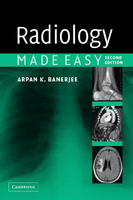 Radiology Made Easy - Banerjee, Arpan K