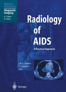 Radiology of AIDS