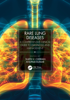 Rare Lung Diseases: A Comprehensive Clinical Guide to Diagnosis and Management - Cherian, Sujith V (Editor), and Kumar, Anupam (Editor)