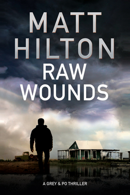 Raw Wounds - Hilton, Matt