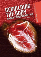 Rebuilding the Body: Organ Transplantation